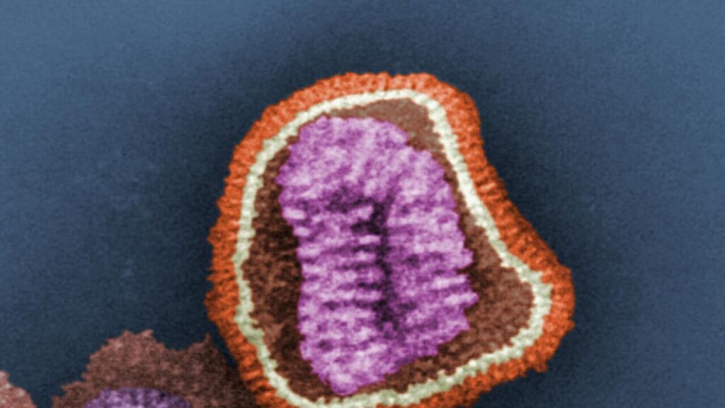 Colorized electron micrograph of a single influenza virus particle