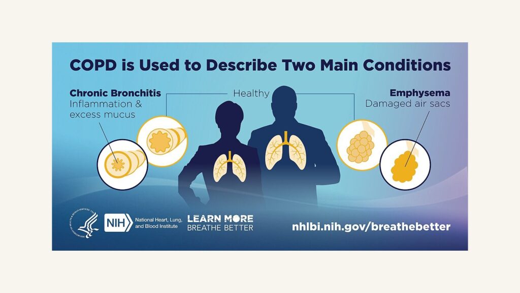 NIH graphic showing healthy lungs beside the two main COPD conditions, chronic bronchitis and emphysema